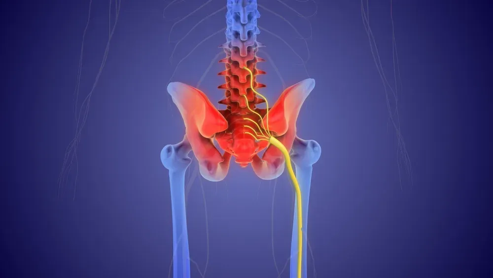 Illustration of the pelvis with the sciatic nerve running down the leg